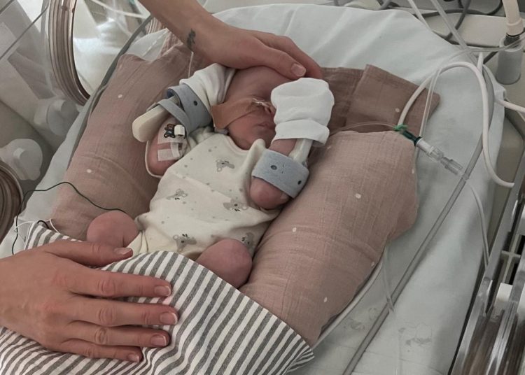 premature baby in neonatal unit